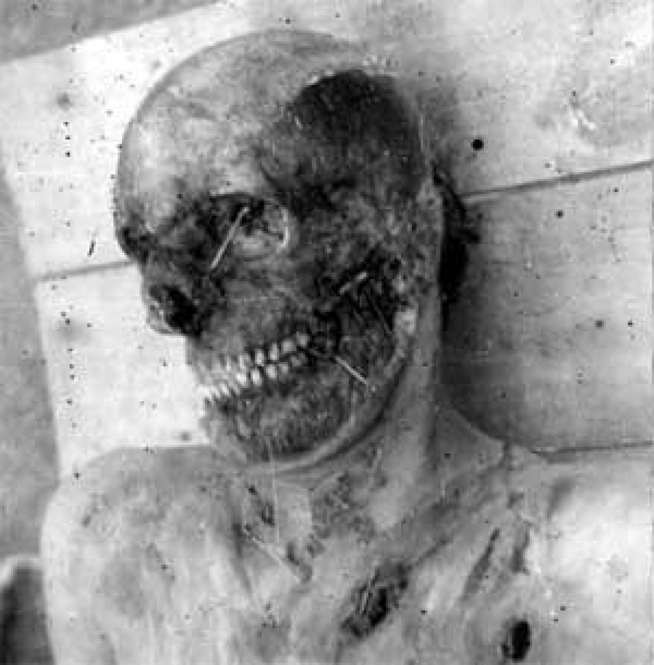 Hocalı  Katliamı 3