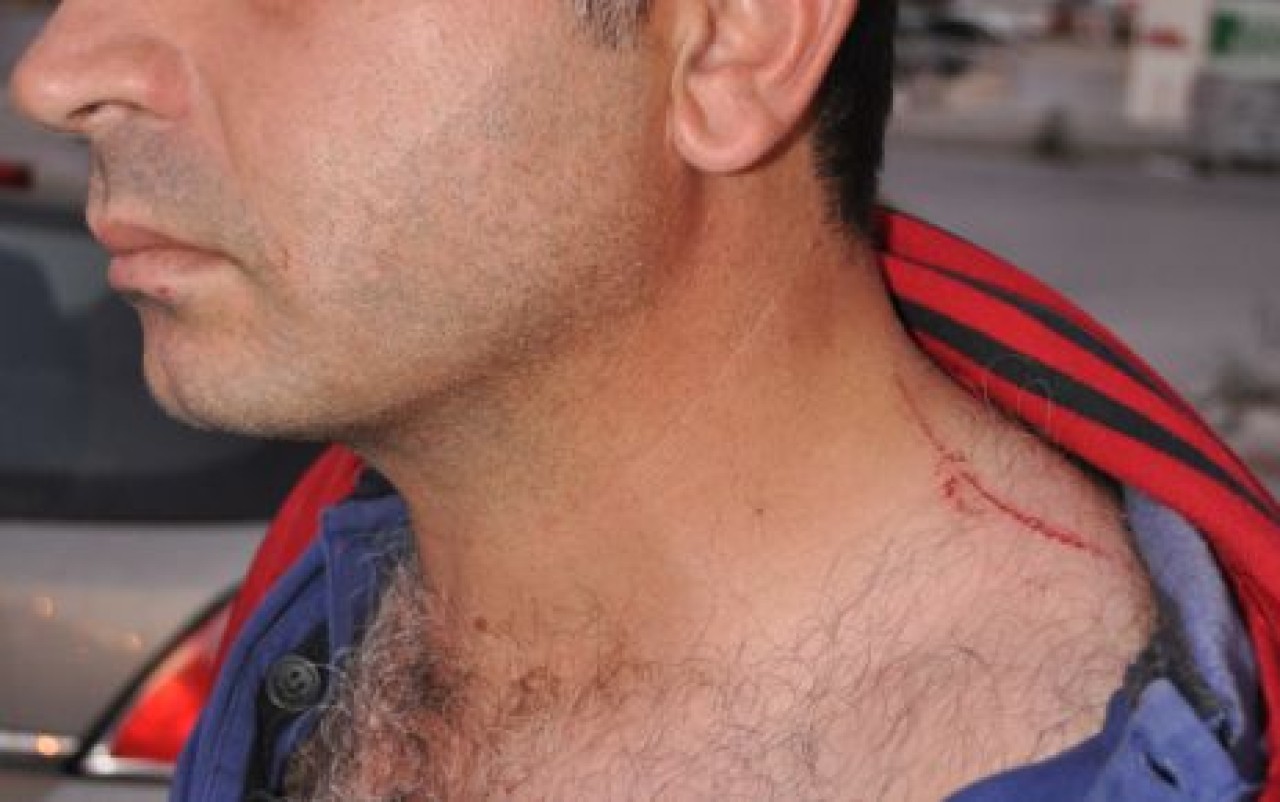 BÖLGEDE MEYDAN GAZETESİ DAĞITICISINA ÇİRKİN SALDIRI...!