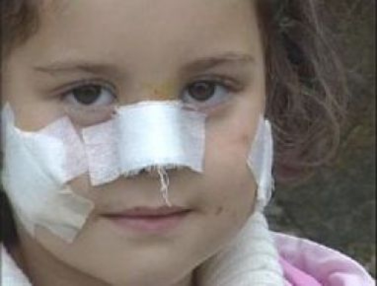 HOROZUN SALDIRISINA UĞRADI