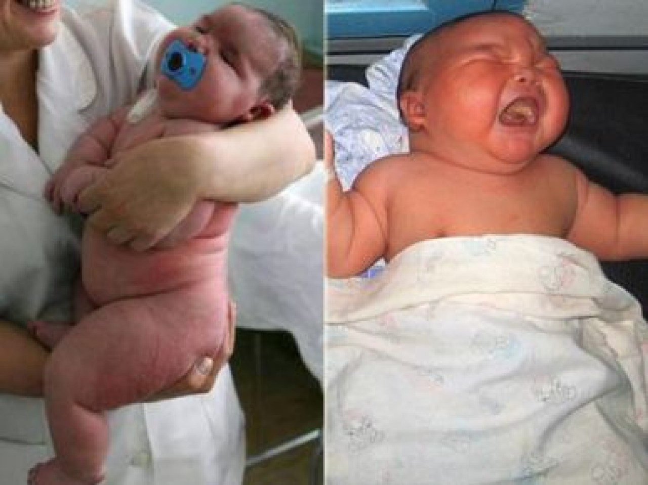 Dünya Bu Çocuğu Konuşuyor