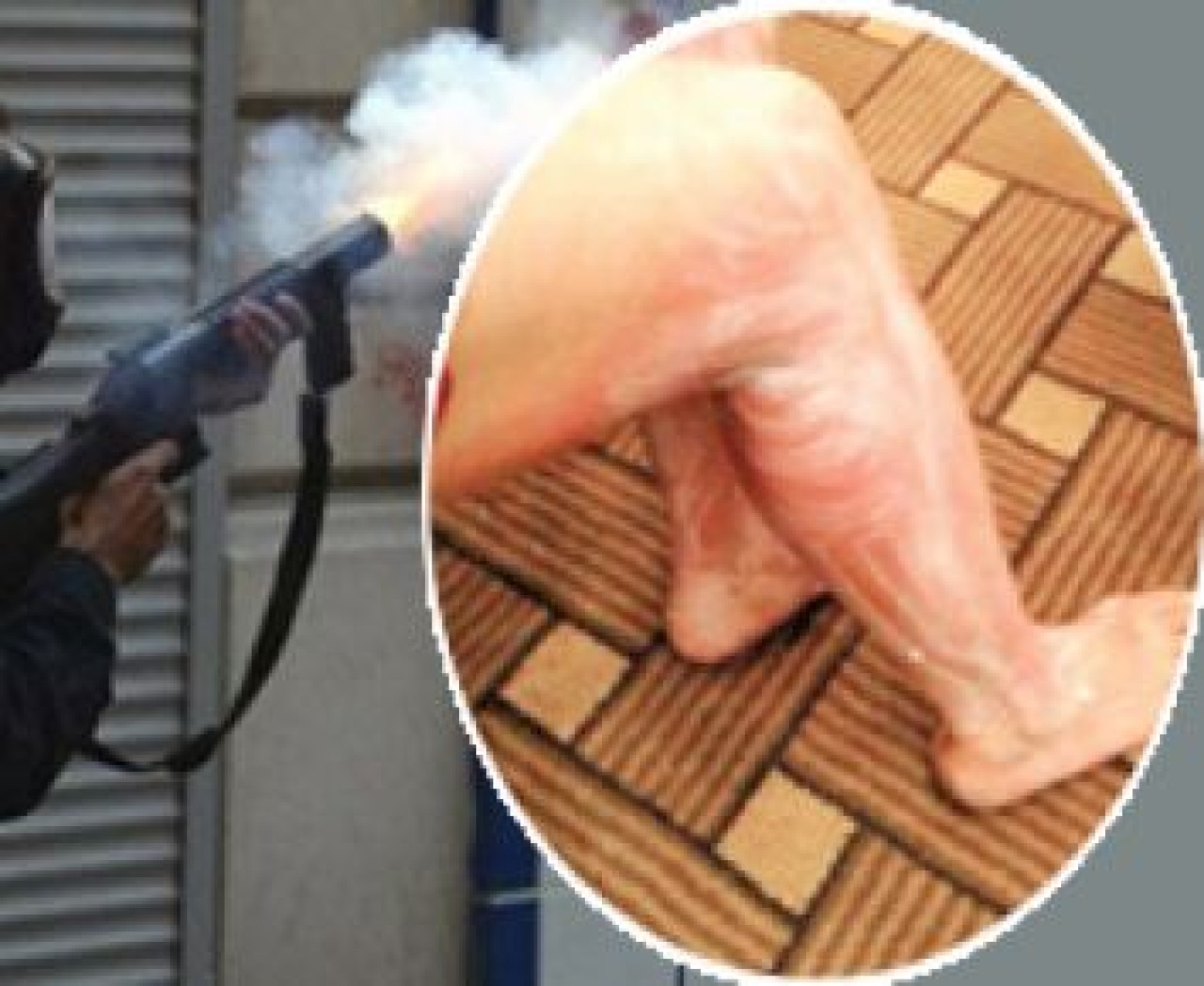 Direnişçiye buhar bombası