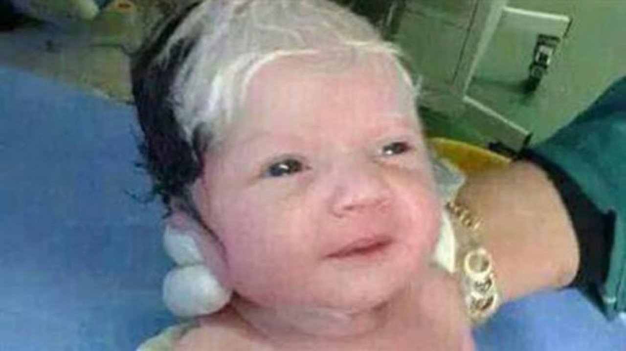 Siyah beyaz saçla doğdu