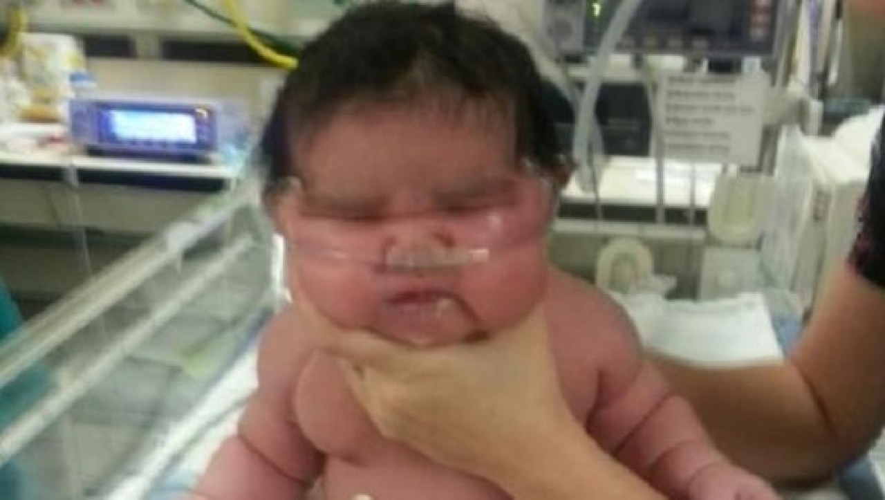 6.2 kilogram doğan bebek, görenleri şaşırttı