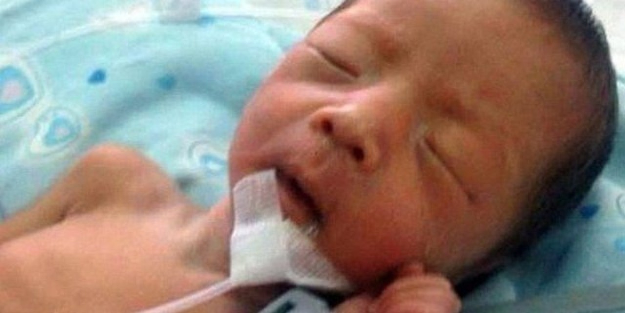 Mezardan çıkarıldı,hayata döndü