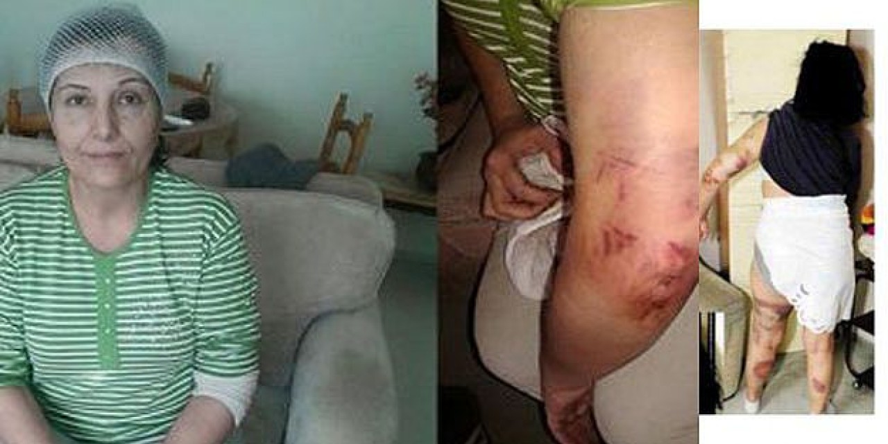 Komşusunu öldüresiye dövdü...