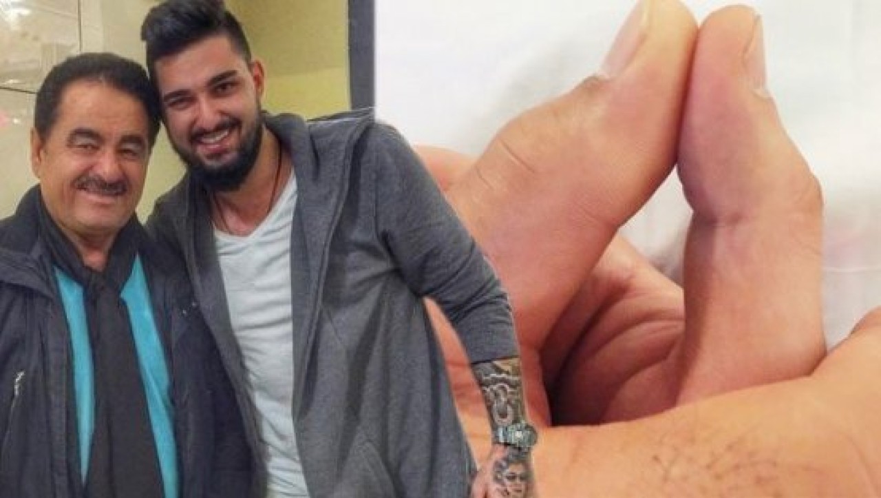 İbrahim Tatlısesin son durumu