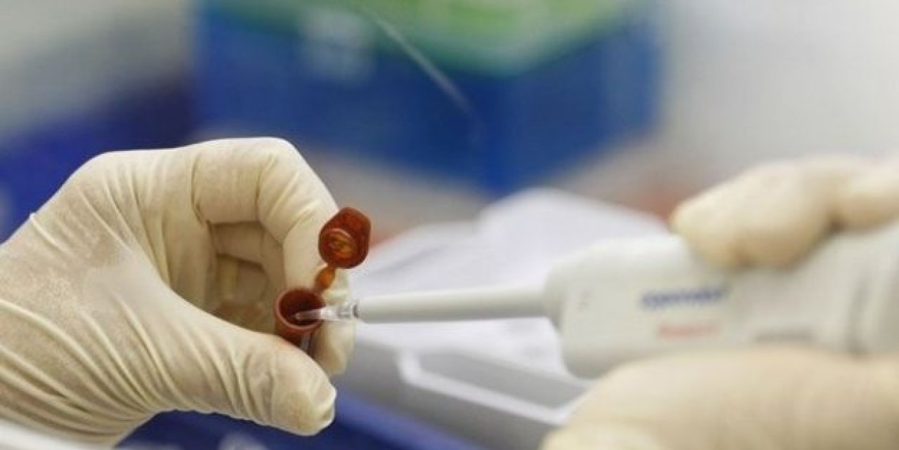 Diyarbakırda domuz gribi alarmı