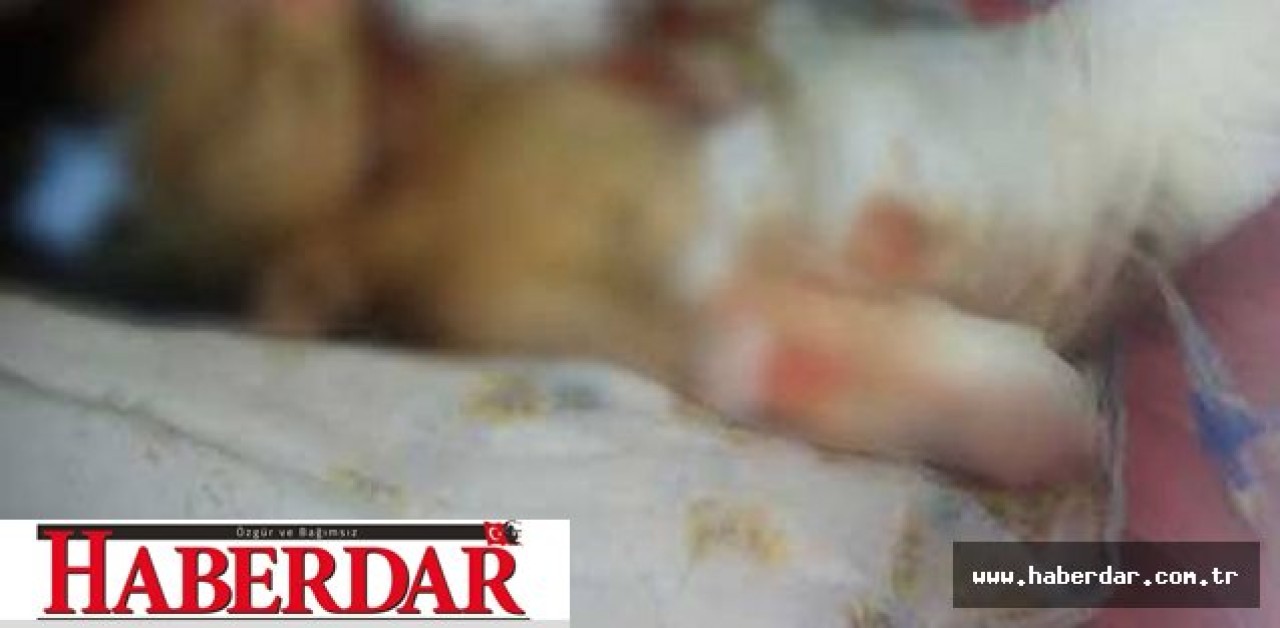 Fareler 10 günlük bebeği öldürdü