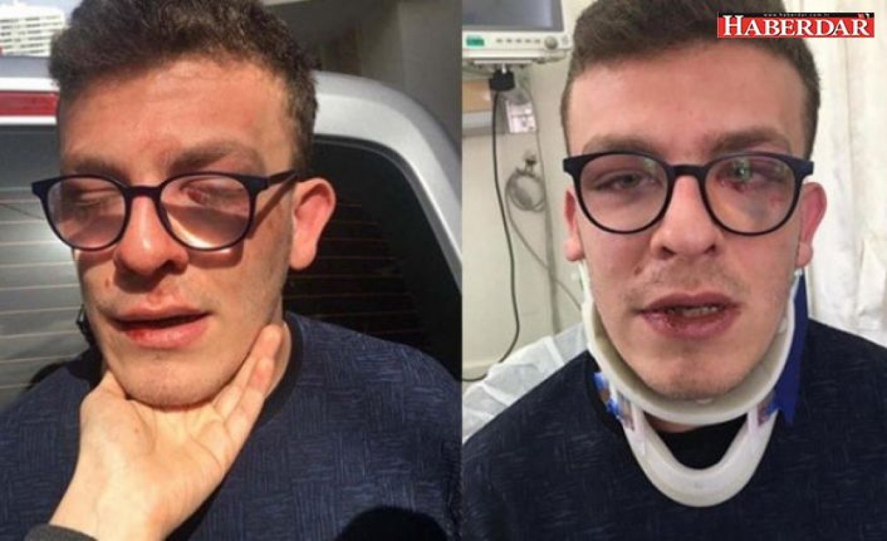 Avcılarda otizmli gence darp eden kişi hakkında yeni gelişme