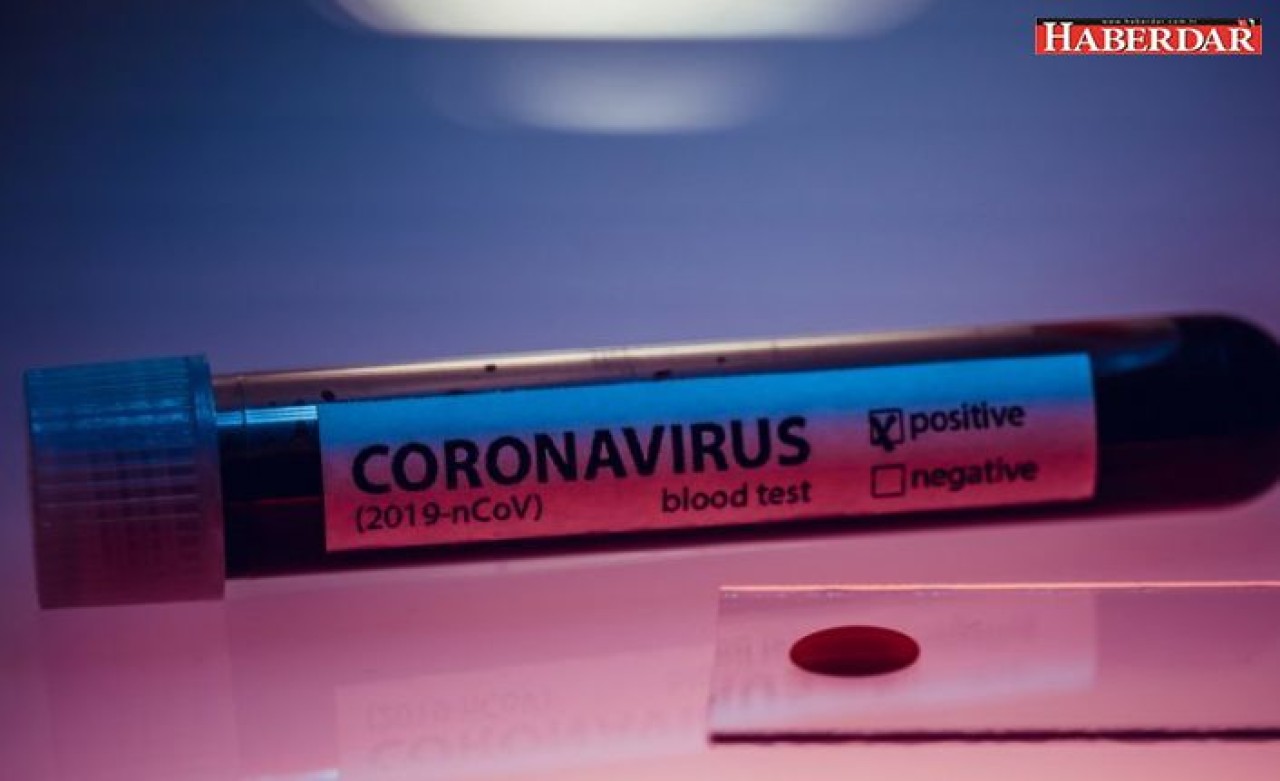 Türkiyede ikinci koronavirüs vakası!