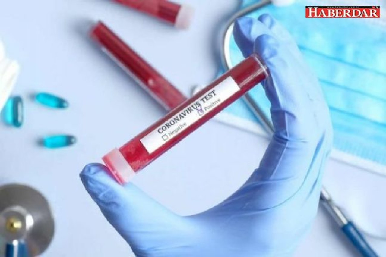 Türkiyede hangi hastanelerde Koronavirüs testi yapılıyor?