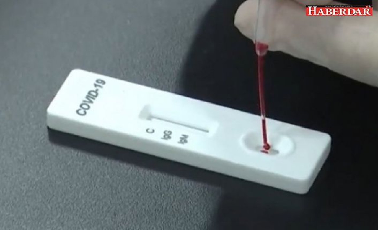 Sürü bağışıklığı beklenmeyecek, herkes için test yapılacak