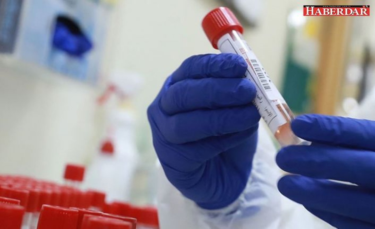 TTBden iki aylık koronavirüs raporu: Ölüm sayıları şeffaf değil