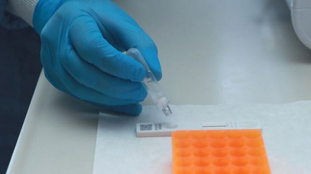 81 il valiliğine koronavirüs talimatı! Yarın yapılacak