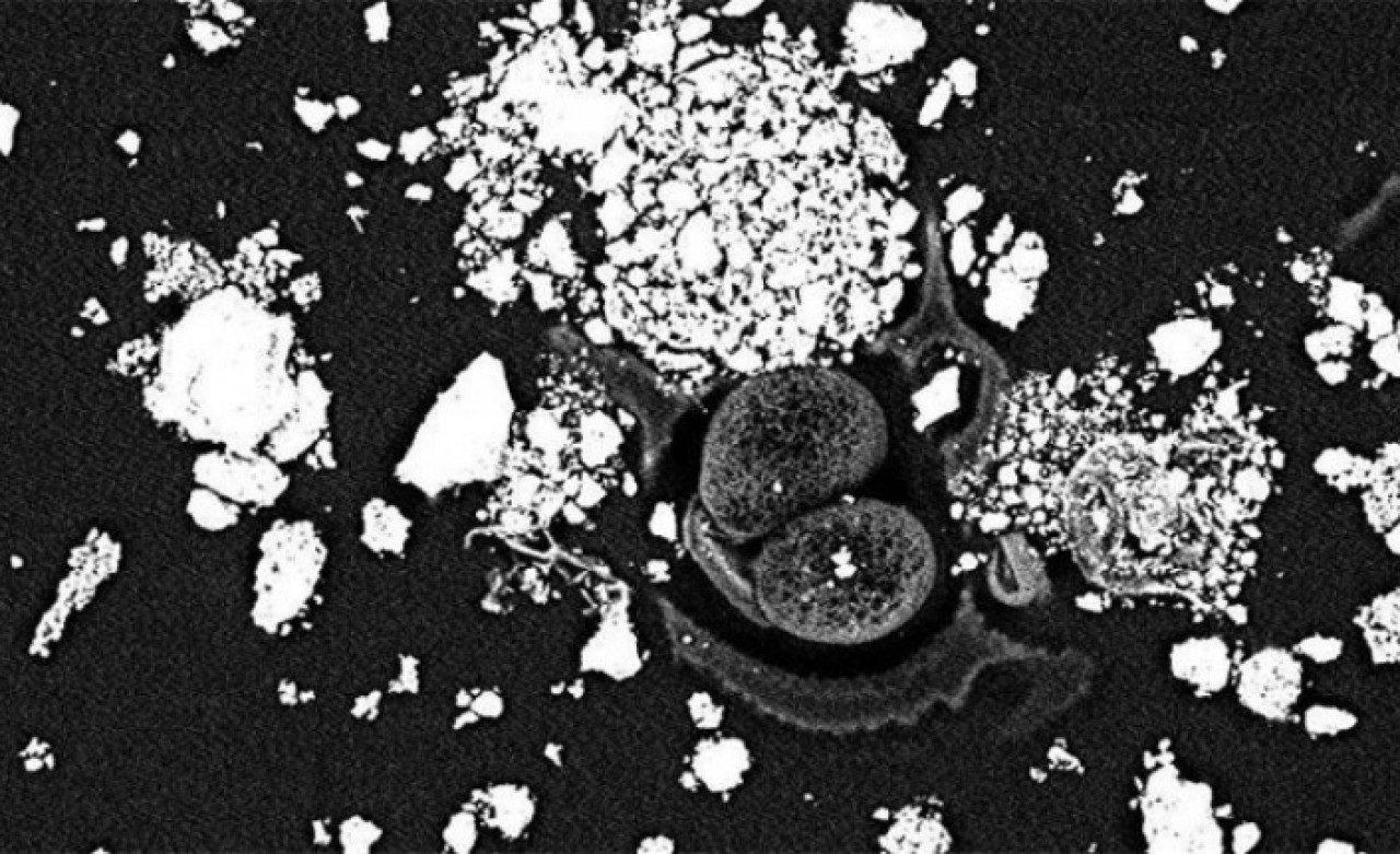 İstanbulda yaşayanlar dikkat! Araştırmadan akciğer kanseri çıktı