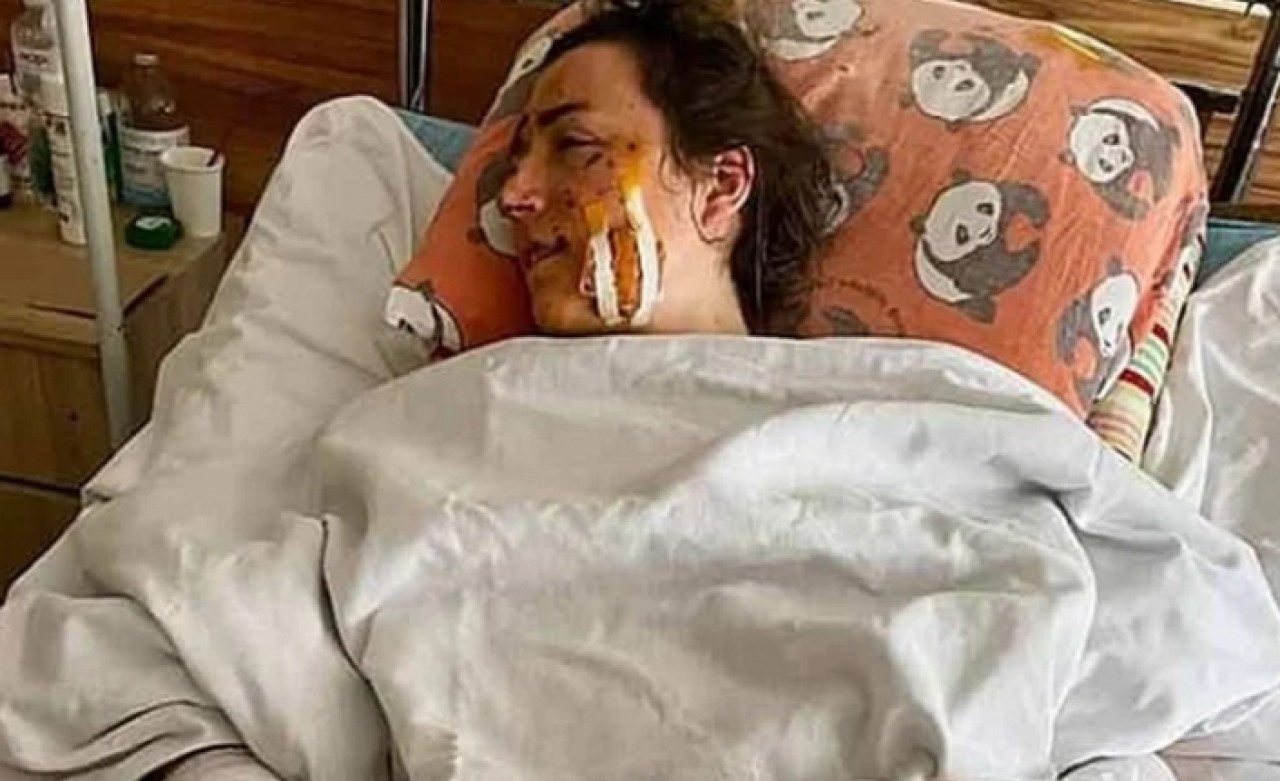 1inci Dünya Savaşından kalma bomba patladı, balayı kabusa döndü!