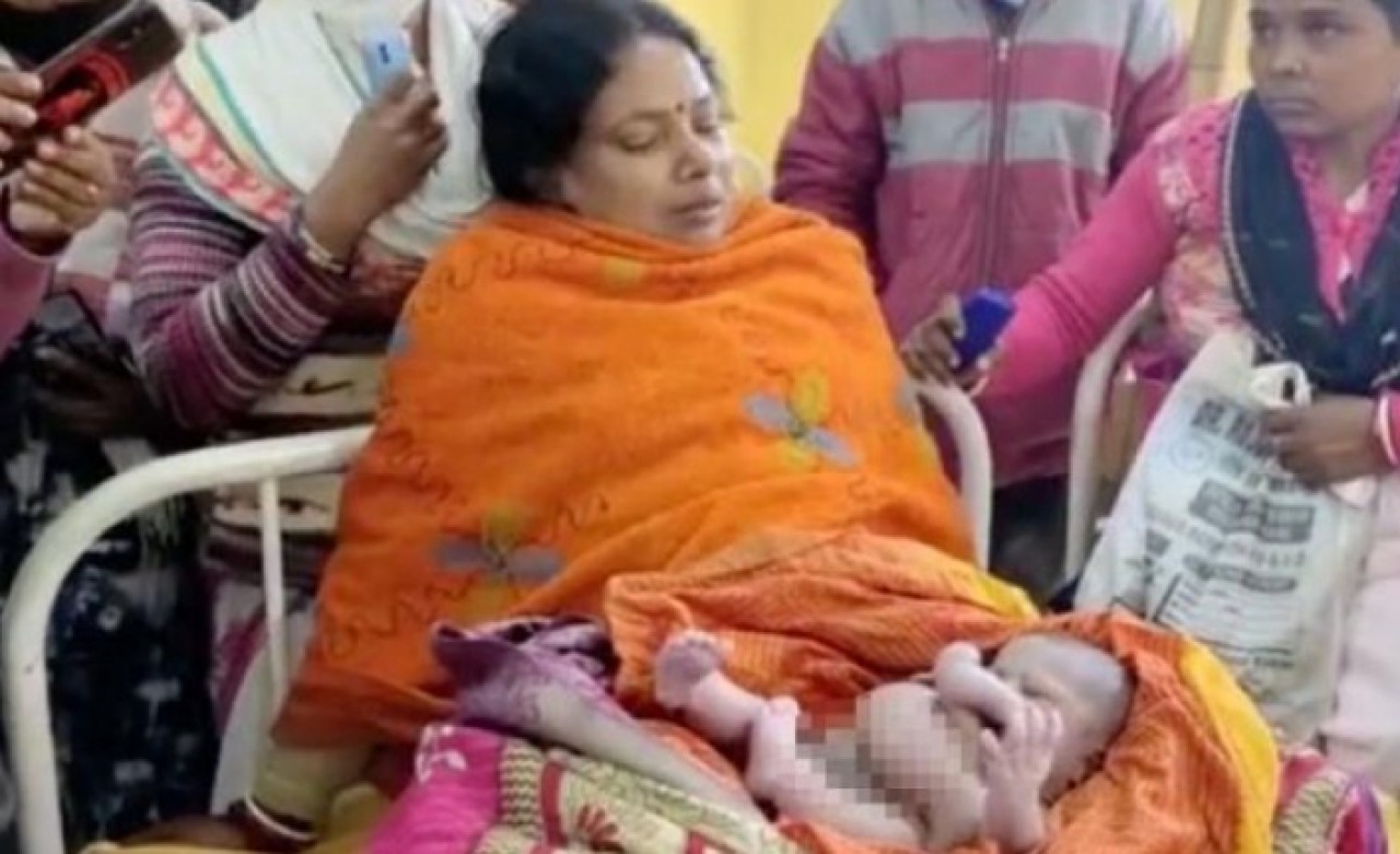 Dört kollu ve dört bacaklı doğan bebek ilahi varlık denilerek hediyeye boğuldu