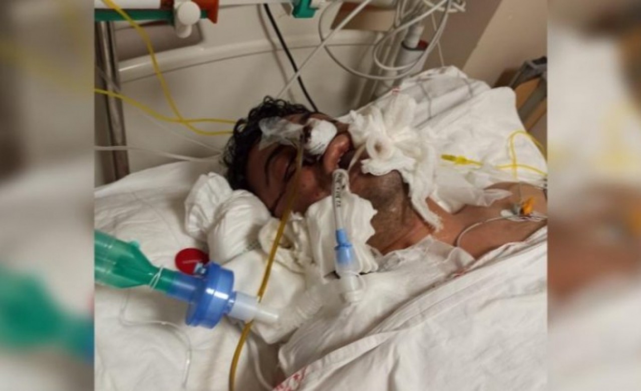 Silivride işkence iddiası; Savcılık bu görüntüye tıbbi müdahale sonucu dedi