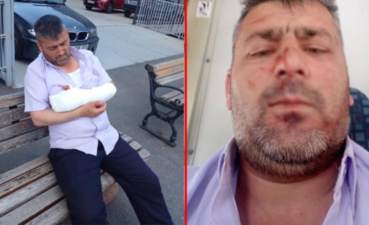 İETT şoförünün çilesi bitmiyor! 2 ay önce taşlamışlardı şimdi de bıçakladılar