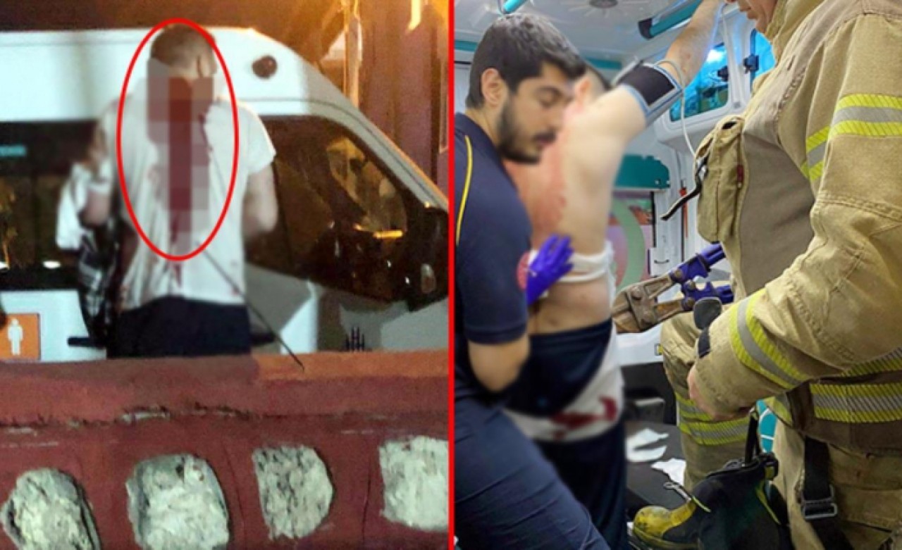 Kardeş kavgası kanlı bitti! Gözü dönen genç, ağabeyinin sırtına zıpkın sapladı