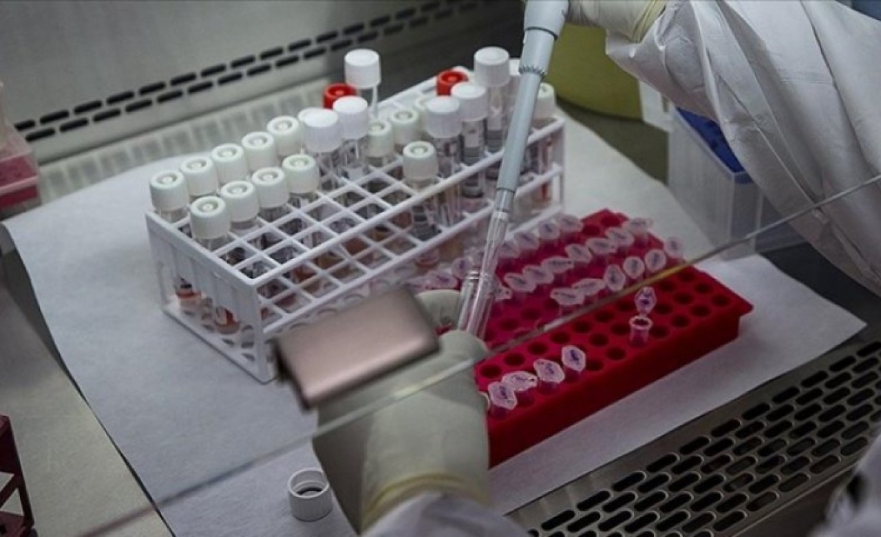 DSÖden maymun çiçeği virüsü açıklaması: Merkez üssü Avrupa