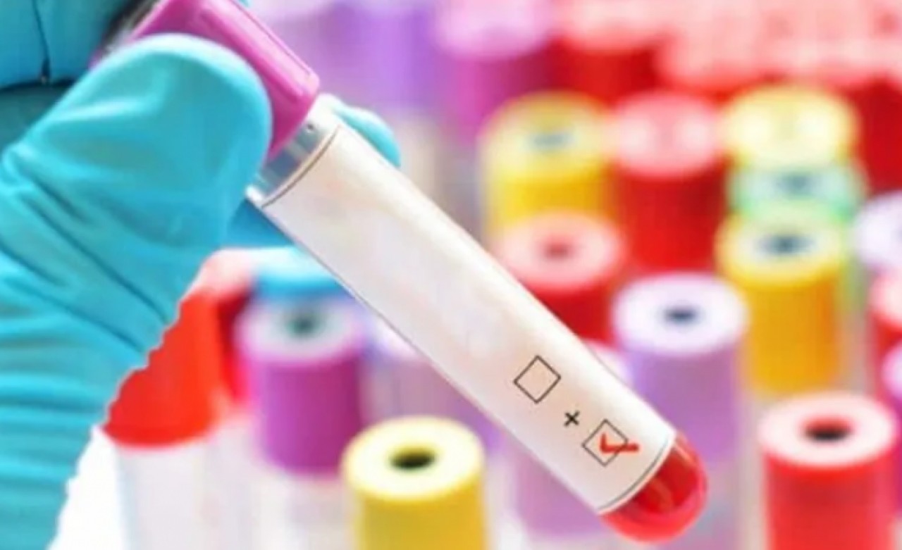 1998den önce doğanlar dikkat: Test yaptırın!