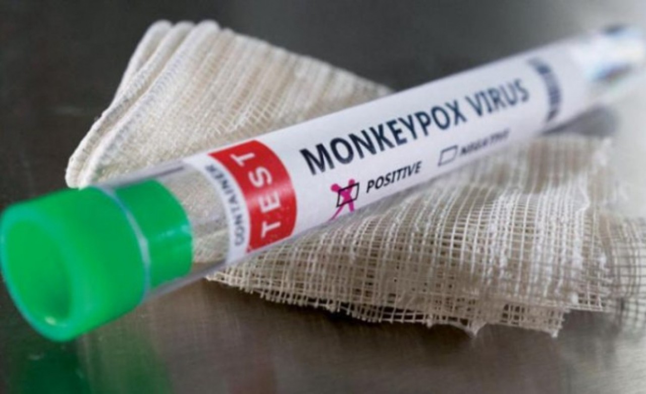 Maymun çiçeğine yakalandı, 3 günde burnu çürüdü!