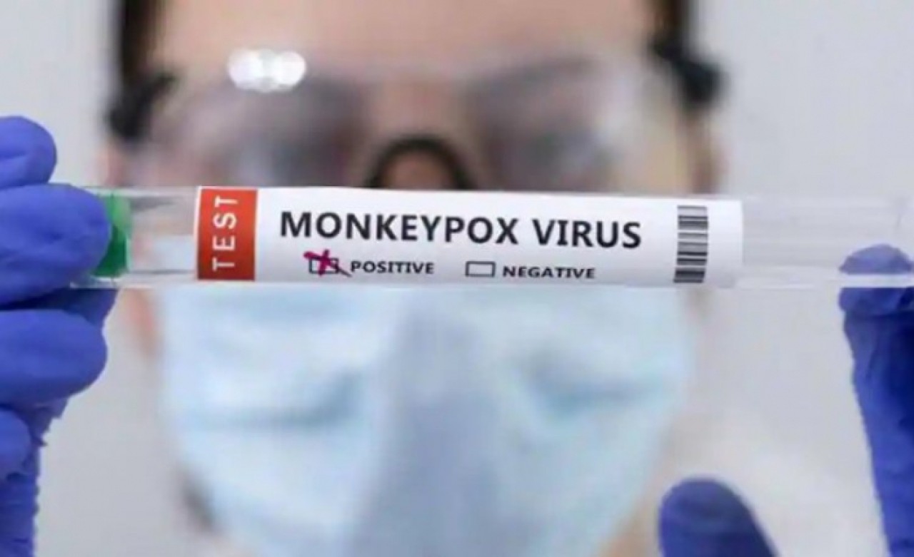 Türkiyede maymun çiçeği vaka sayısı 11e yükseldi