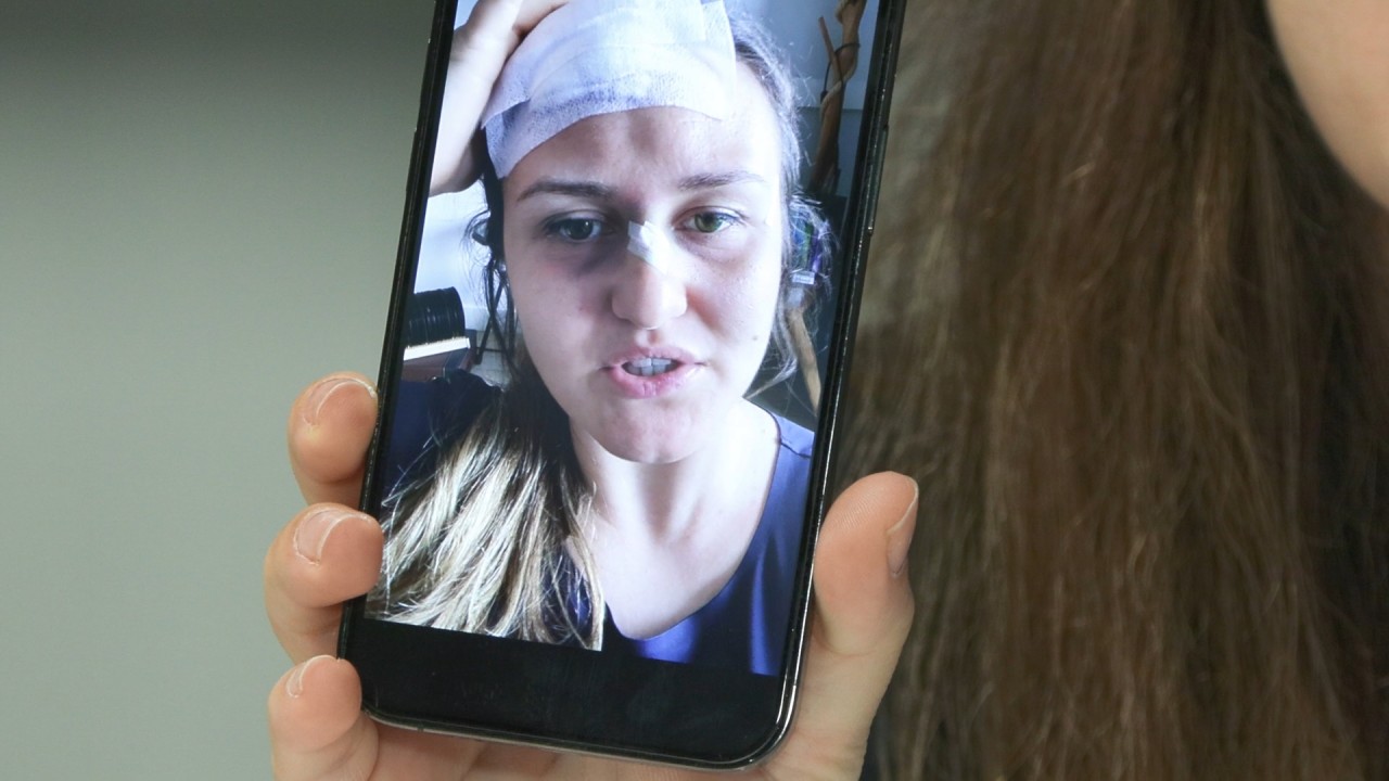 KONSERE GİTTİ SAĞIR KALDI!