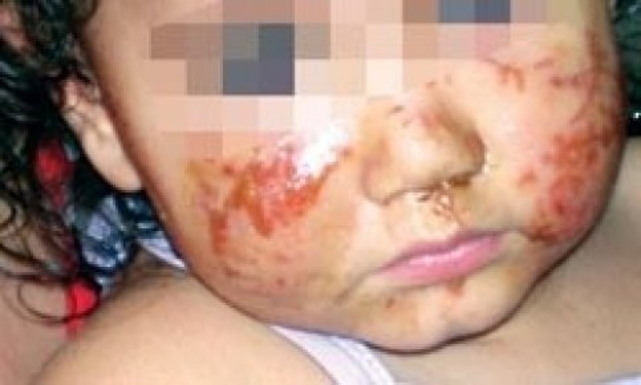 Kreşte ‘küçük’ bir sorun var