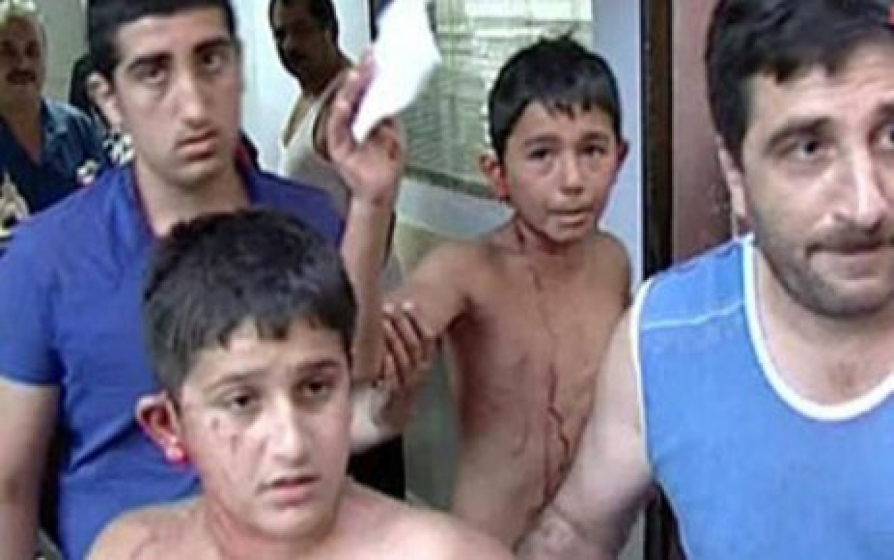 Avcılar'da pitbull dehşeti