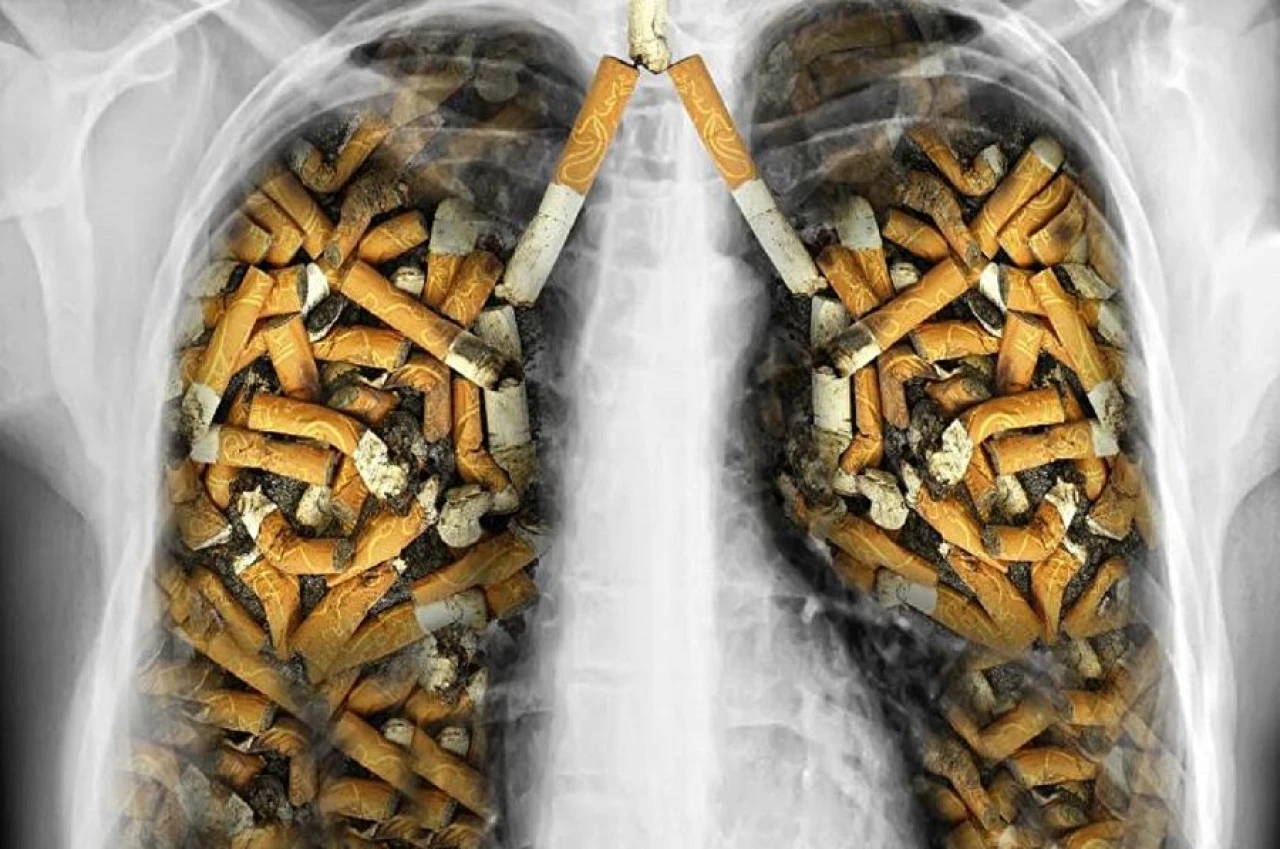 Akciğerin düşmanı tütün