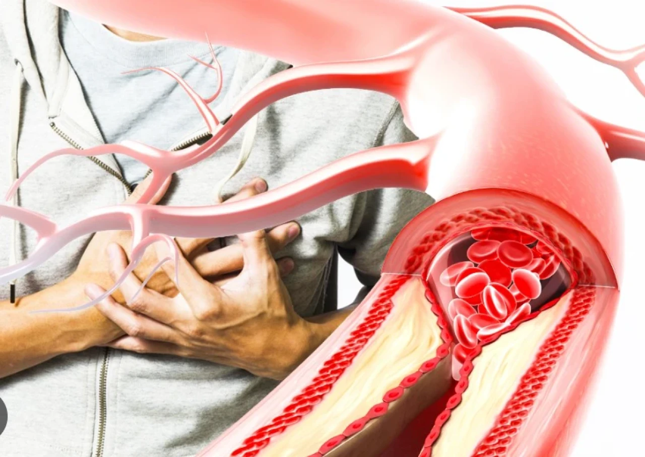 Şeker damarları tıkıyor