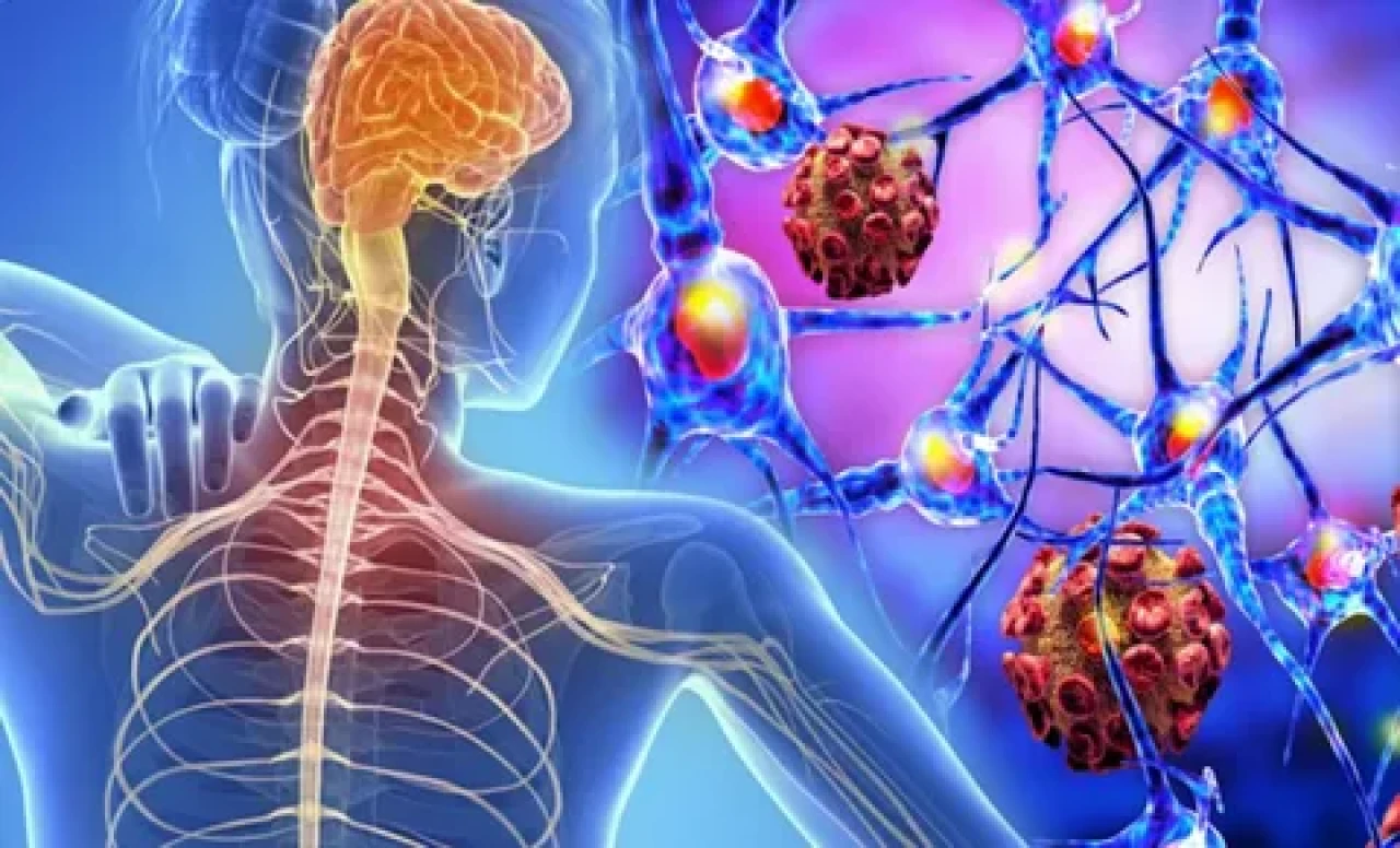 MS Hastalarına Umut