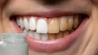 Ev tipi karışımlar diş minesini aşındırıyor !