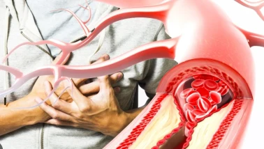 Şeker damarları tıkıyor