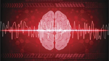 Ölüm anında beyin aktivitesi ilk kez görüntülendi...