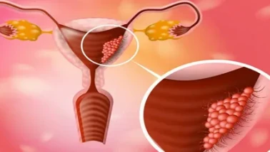 Önlenebilir bir kanser türü !