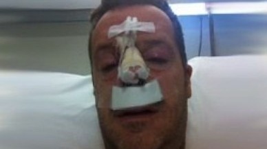 Can Tanrıyar saldırıya uğradı