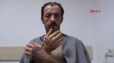 Oğlu sopayla vurdu, eşi benzin döküp yaktı