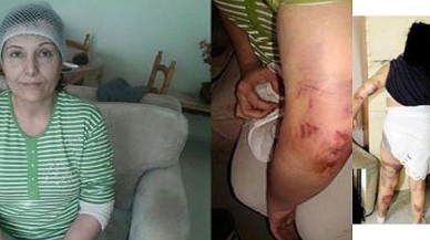 Komşusunu öldüresiye dövdü...