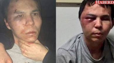 Sigara izmariti ele verdi!