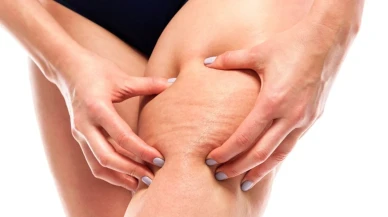 Lenfödemin Tedavisinde Gecikmeyin!