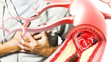 Şeker damarları tıkıyor