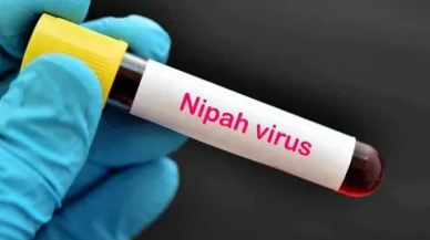 Nipah Virüsü (Niv) ile İlgili Merak Edilenler