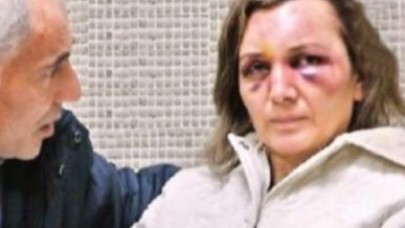 İlkel erkek örnek aldı