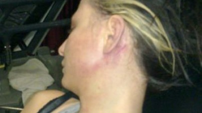 Bar dönüşü işkence