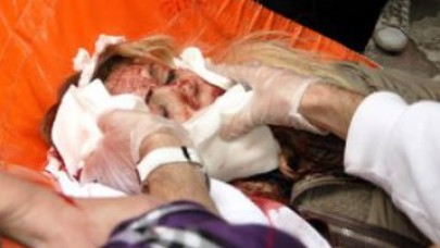 Eski eşini sokak ortasında falçatayla yaraladı