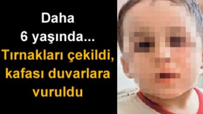 Minik çocuğun tırnaklarını çekti