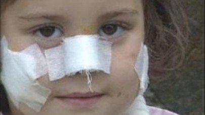 HOROZUN SALDIRISINA UĞRADI